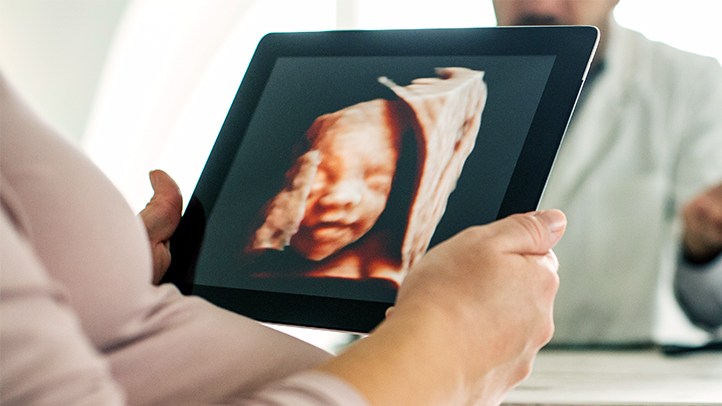 3d and 4d ultrasound pregnancy