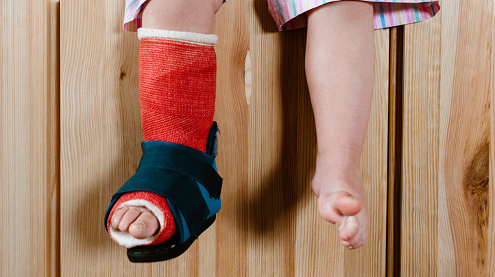caring for a child in a cast, toddler with leg in a cast