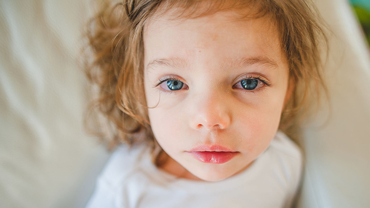 pink eye in babies and toddlers, toddler girl with pink eye