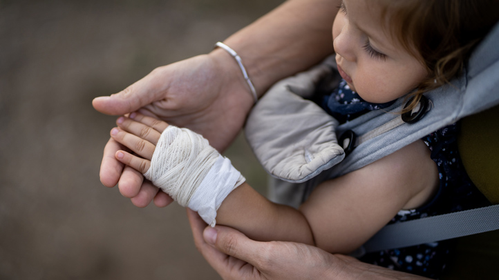 toddler sprains, little girl with bandage around her hand