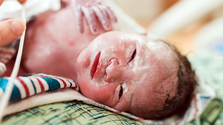 newborn baby right after birth, what is the vernix